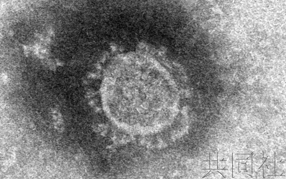 各国试用现有药物治疗新型肺炎 亦有改善病例